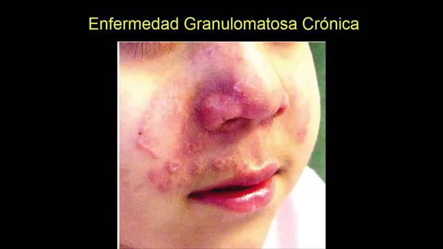 Herramientas geneticas