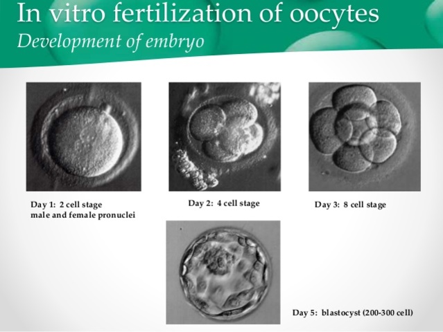 In Vitro Fertilisation