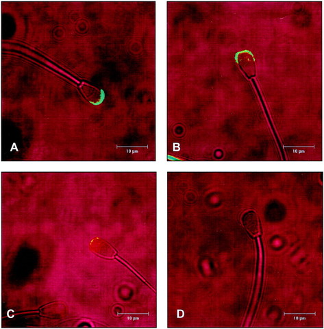 First Microscope Detection of Sperm