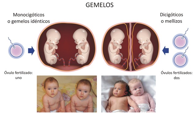 Distinción de gemelos