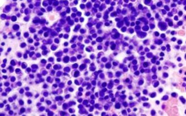 La terapia génica se incorpora al arsenal contra el cáncer