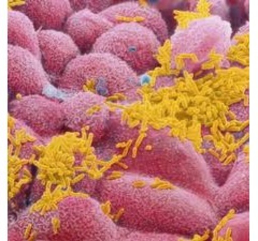 Primer secuencia de genoma en organismo vivo