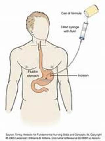 Alimentacion Continua