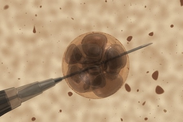 Francis Galton acuña el término eugenesia