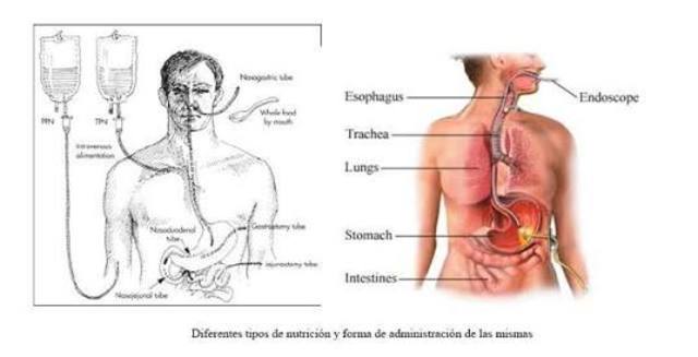 Aparecen las nutriciones inmunomoduladoras