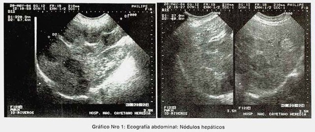 ANDREY SEBASTIAN AZCARATE JARAMILLO