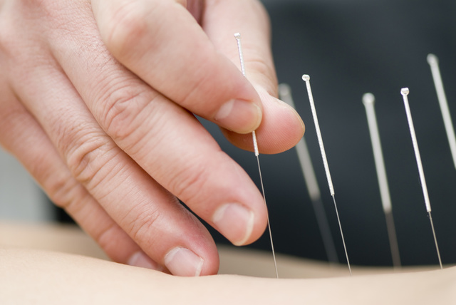 First physican to use acupuncture