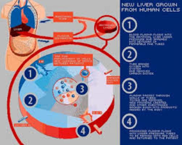 Artifical Liver