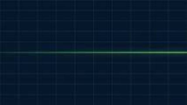 Died while in surgery