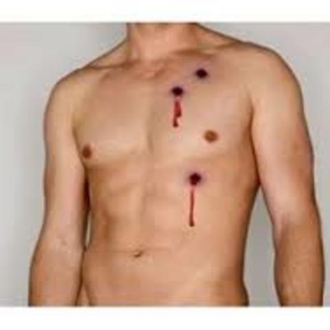 O'Brien gets shot for the second time