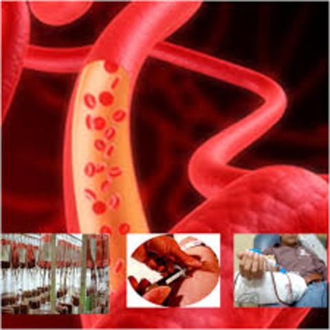 Transfusión Sanguínea