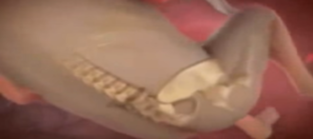 El esqueleto también tiene cambios