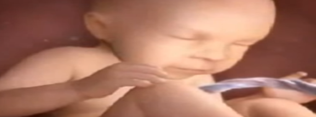 Puede sobrevivir con ayuda médica