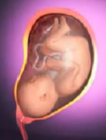 Se acomoda para el alumbramiento