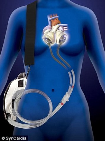 Artificial Heart