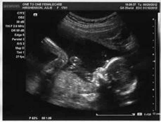 Adam Nicholas Escobar