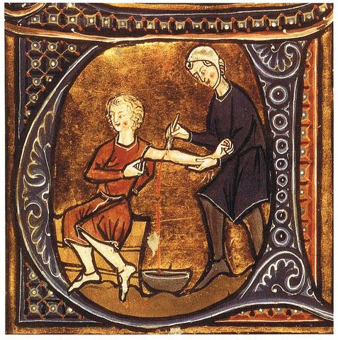 Amputation in the Middle Ages