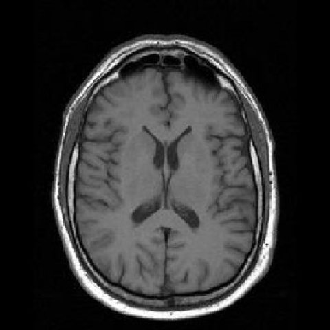 The first mr image of the brain.