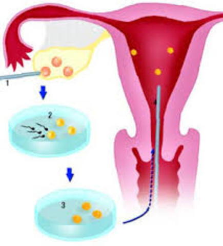 In vitro fertilisation