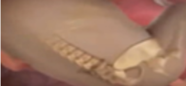 Huesos desarrollados