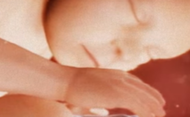 Su piel es rosada y suave