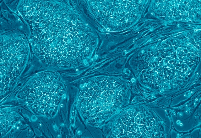 Embryonic Stem Cells