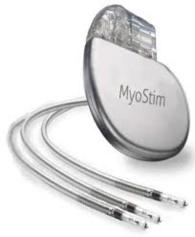 The  cardiac pacemaker was invented