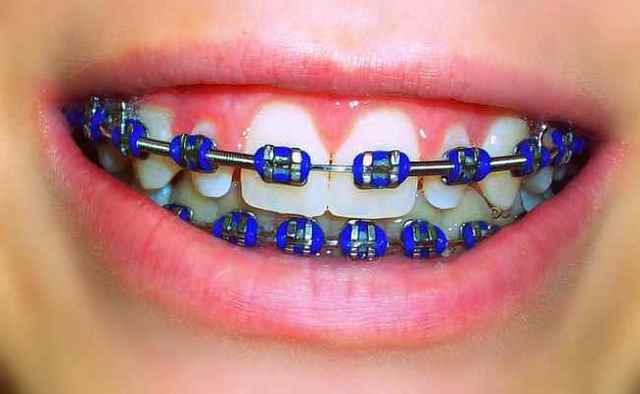 Orthodontist