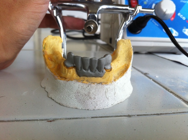 Mecánica Dental