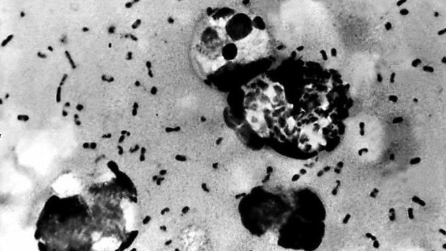 Peste Bubónica (Robert Koch)