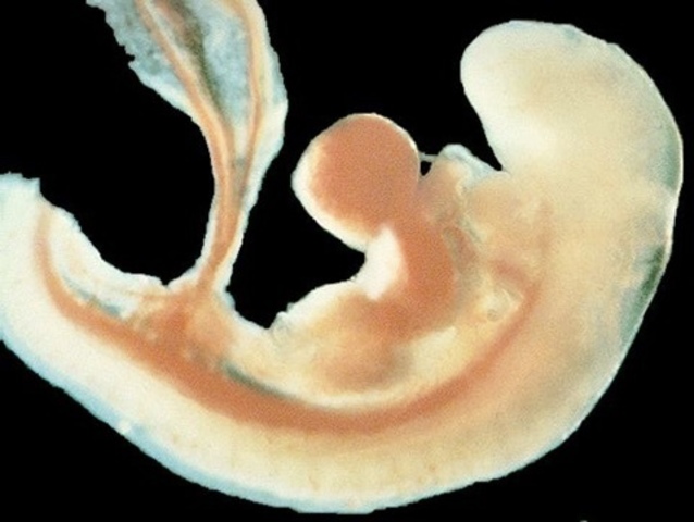 2 Semana (Embrión)