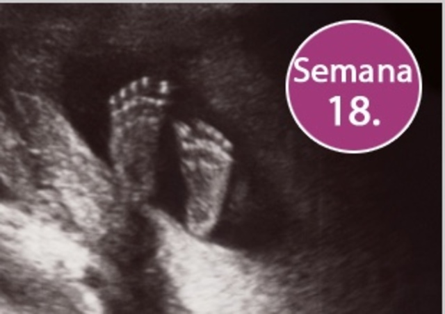 18 semanas