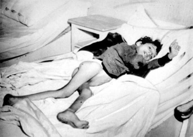 Introducción de la "Hungerkost" (Muerte por dieta de hambre) en todos los sanatorios de Alemania. Alrededor de 90.000 personas mueren como resultado de esta orden.