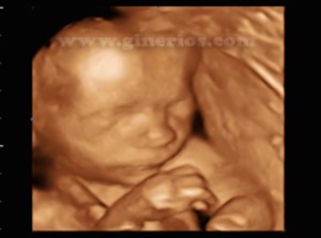 Semana 22 de embarazo