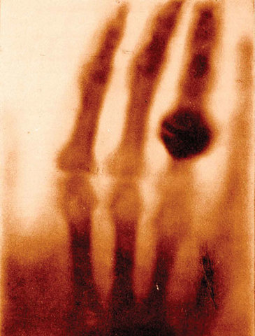 Discovery of the X-ray