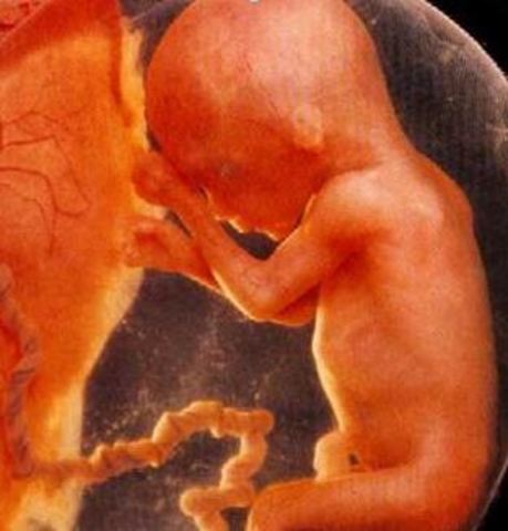 Cuarto mes  (11 a 14 semanas)