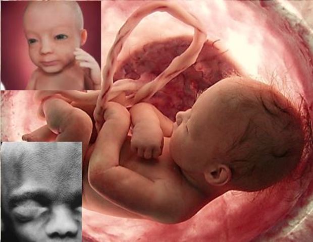 Sexto mes (19 a 22 semanas)