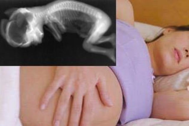 Séptimo mes  (23 a 26 semanas)