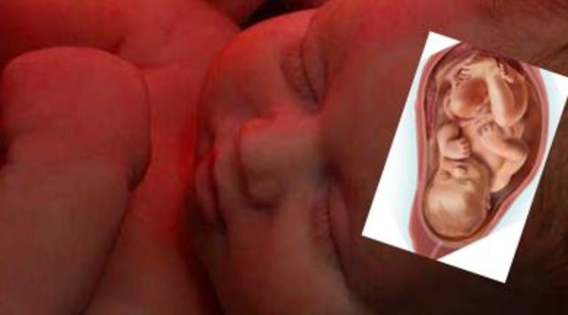 Noveno mes (31 a 34 semanas)