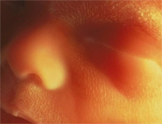 Fase fetal 5to. mes (semanas 17-20)