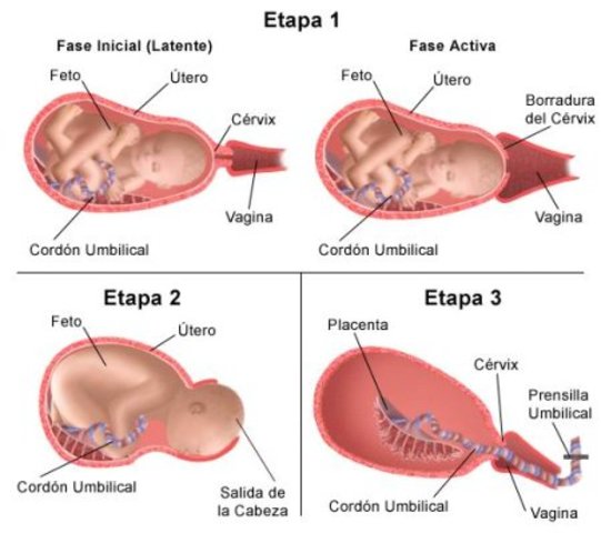 Inicio del trabajo de parto.