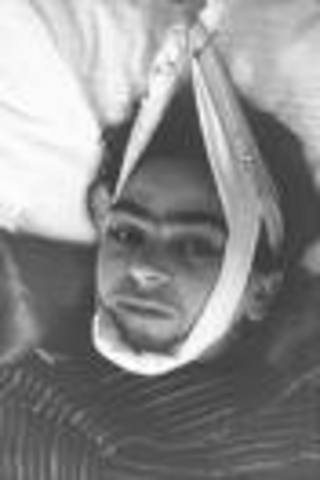 she also suffered from spina bifida, when she was six years old