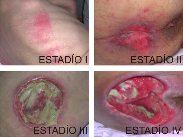 Aplicación de conocimiento