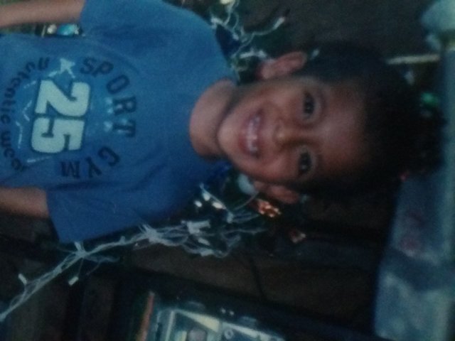 ETAPA DONDE SE ME CAYERON LOS DIENTES