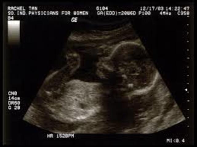 Month 5 Development of The Baby