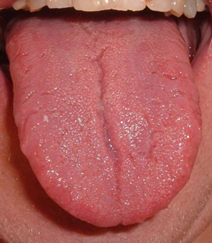 Tongue and taste buds