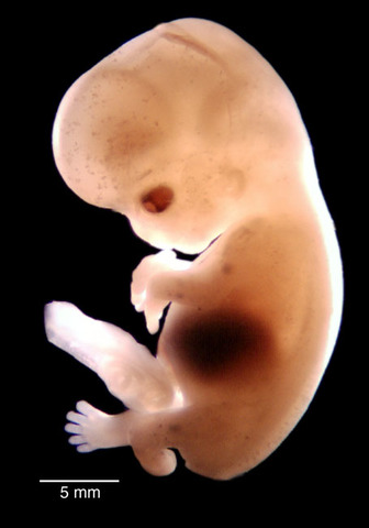 Embryo