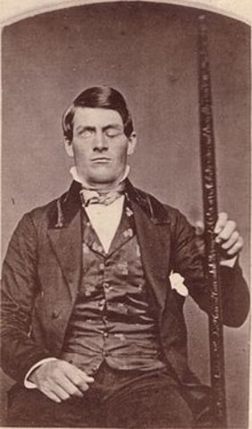Phineas Gage sufrió daño cerebral cuando un poste de hierro le atraviesa el cerebro. Su personalidad se cambió, pero su intelecto permaneció intacto lo que sugiere que un área del cerebro desempeña un papel en la personalidad.