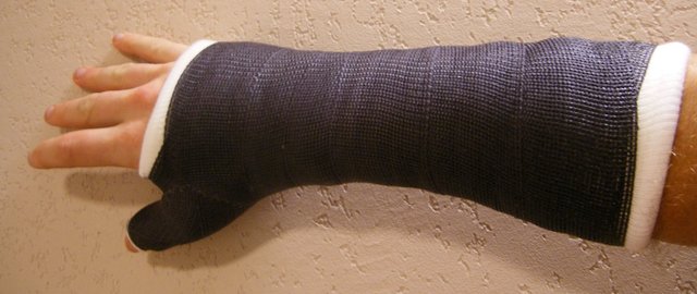 Broke My Wrist