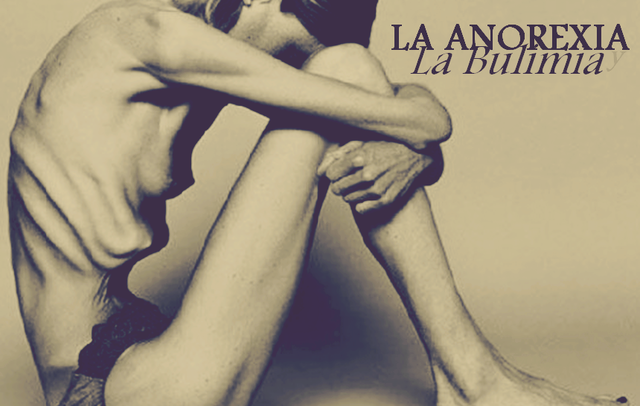 ANOREXIA Y BULIMIA
